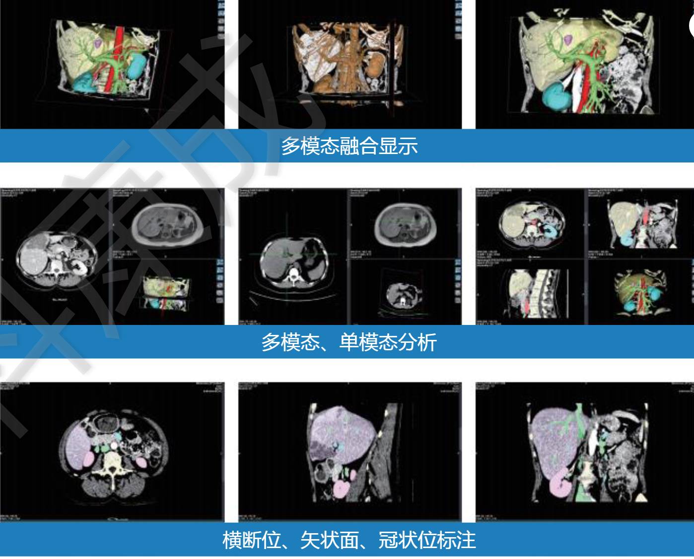 康成睿视-3D医学影像处理软件